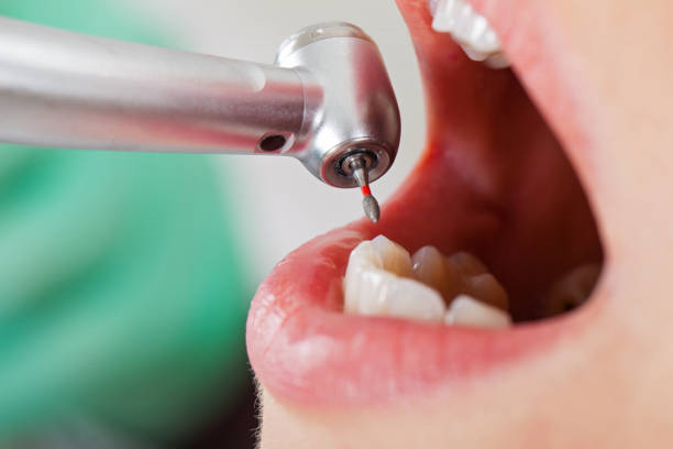 Best Pediatric Emergency Dentist in Reisterstown, MD